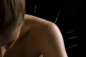 Acupuncture. shoulder larger